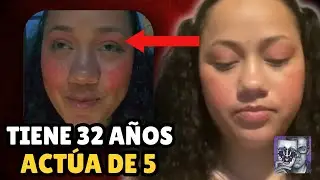 TIENE 32 A&Ntilde;OS PERO DICE TENER 5: El caso de la Transedad Estrellita que Alumbra (Con PsicoVlog)