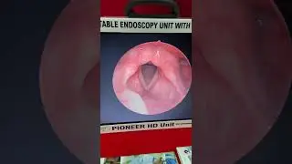 New HD portable Endoscopy Unit by Pioneer,www.pioneermedical.net,+91-9837967209