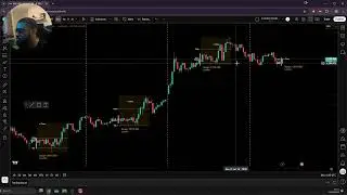 Investment Insights | 13th January 2026 | XAUUSD | Market Profile Trading | Rax Global