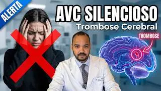 Trombose venosa cerebral: conhe&ccedil;a esse tipo de AVC!