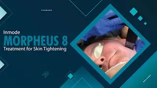 Inmode | Morpheus 8 | Treatment for Skin Tightening | West Hollywood, CA | Dr. Jason Emer