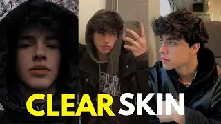 BRO! Achieve Your Peak | Get Clear Skin Using these 7 Steps