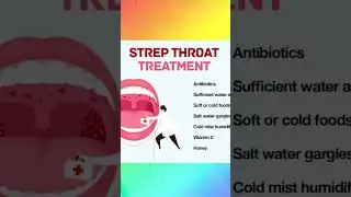 Strep throat #youtubeshorts #youtube #throatinfection