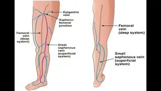 Small saphenous vein Communicating veins with great saphenous, Giacomini vein