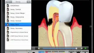 DDS GP iPad App Hints.mov