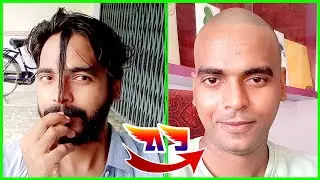 AJ की सर की बाल गायब | चेहरा उदास | Aj Masti Group
