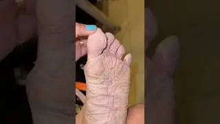 MEU P&Eacute; DEPOIS DE CORRER 58 KM 😱🤯