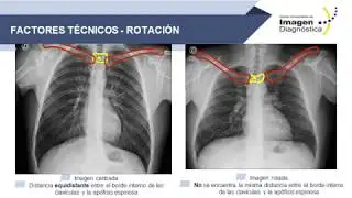 Imagenología de Tórax: Anatomía y Aspectos Técnicos