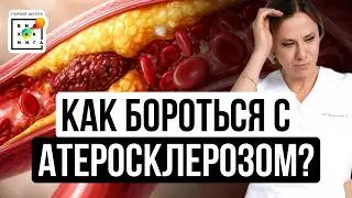Жировые бляшки на сосудах: как бороться с атеросклерозом? #сердце #пшб #иринабаранова