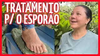 TRATAMENTO PARA O ESPORÃO - palma do Figo da Índia - CURA NATURAL