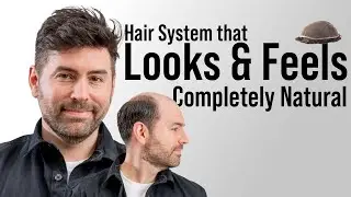 A Hair System So Good, No One Would Question Its Authenticity!🙌