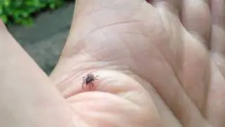 Tick crawling over my hand