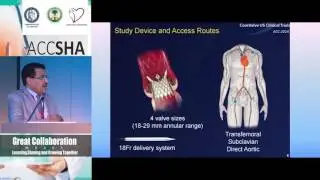 Moheeb Al Abdullah Self expanding versus Balloon expanding Transcatheter Aortic Valve Implantation T