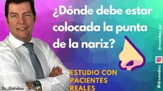 Rinoplastia Ultrasónica Ambulatoria - ¿Dónde debe estar colocada la punta de la nariz?