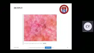 A NEW DEEP LEARNING MODEL FOR SKIN CANCER CLASSIFICATION