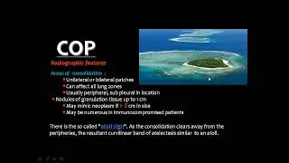 HRCT of diffuse lung disease II DRE Prof  Mamdouh Mahfouz HD