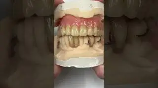 Process Denture and Acrylic Partial @EnvisiontecMain #envisiontec #dental #smile #teeth