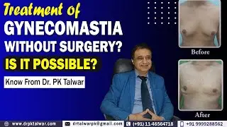 Gynecomastia Without Surgery? Is is Possible to Treat Male Breast Without Surgery | Dr. PK Talwar