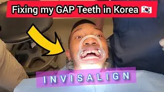 Fixing My GAP Teeth in Korea! | Invisalign | Cost and Initial Experience