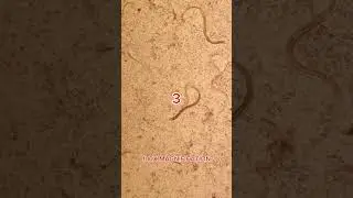 Vodka vs Parasites under the microscope