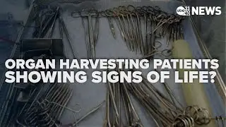 'Unethical': HHS report reveals organ harvesting while patients still show signs of life