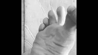 Bunions, big toes & plantar fasciitis | Observing & understanding big toe bioflow in plantar fascia