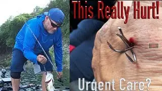 Is FISHING a full contact sport? Topwater at Bull Shoals Lake gets a visit to the E.R.