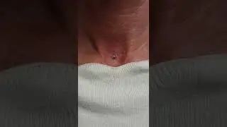 The Piercings Alkmaar. MicroDermal Piercing by Ferry. www.thepiercings.eu / Insta:@thepierc