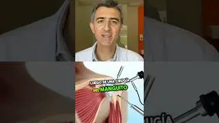 &iquest;Cu&aacute;nto tiempo demora la recuperaci&oacute;n de una cirug&iacute;a del MANGUITO ROTADOR?