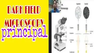 Darkfield Microscopy Principle Working Mechanism Advantages & Difference between Bright Dark field