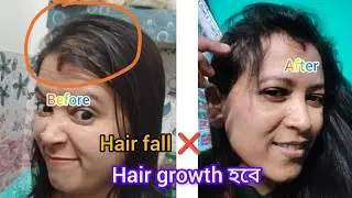 15 days challenge :hair growth / hair fall ❌ এই রেমিডি তে hair fall বন্ধ হবেই