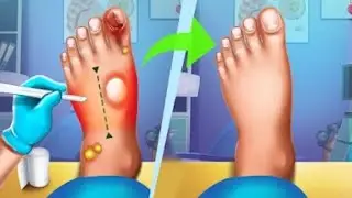 Foot Surgery Doctor Care Gameplay Walkthrough Level 01 - Android,Ios