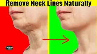 How to Get Rid of Neck Lines | Fix Saggy Neck Skin