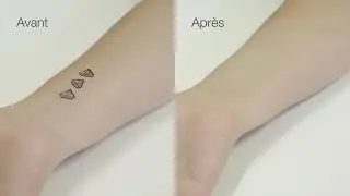 Covermark - Comment camoufler un tatouage ?