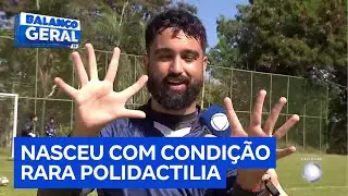 Goleiro com seis dedos em cada m&atilde;o viraliza nas redes e se destaca no futebol | Balan&ccedil;o Geral DF