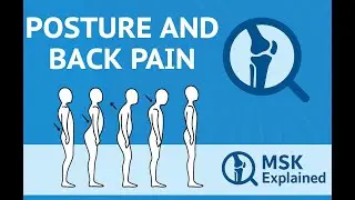 Posture and Low Back pain &mdash; What Research Says About Sitting, Standing, and Back Pain