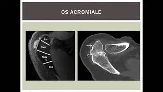 01 Anatomía del hombro