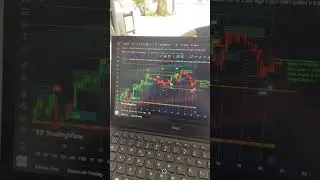The Most Insane Trading Tool Ever 🔥 #trendfollowing #tradingsignals