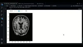 0.1 - SimpleITK review - Course MRI preprocessing with Python