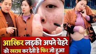 आखिर लड़की अपने चेहरे को खराब कर देती है फिर जो हुआ 😳 #viralvideo 