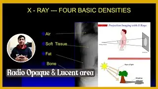 Radio Opaque & Radio Lucent area (X-Ray interpretation easily) Bangla