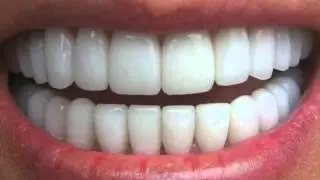 Get Perfectly Straight Teeth ―∎ affirmations | Cure Overbite, Underbite & Crossbite