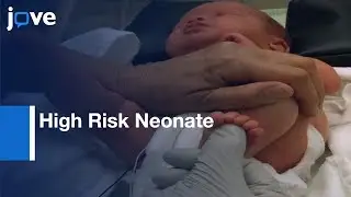 Assessment & Evaluation Of High Risk Neonate: NICU Network Neurobehavioral Scale l Protocol Preview