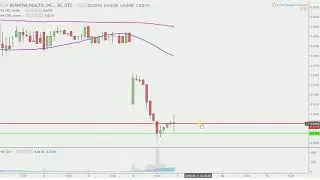 Rennova Health, Inc. - RNVA Stock Chart Technical Analysis for 05-10-18