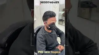 Most Premium Skin Base Hair Patch System | 100% Natural Look #hairreplacement #hairsystem #shorts
