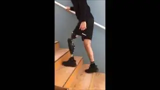 Essai d'une prothèse orthopédique