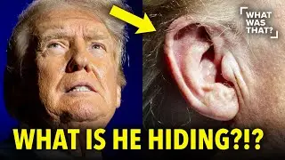 Trump HIDING Medical Records After Shooting