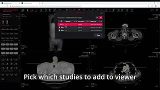 MedDream DICOM Viewer: patient history
