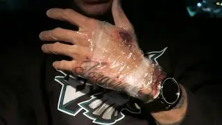 I Tattooed My Hand!