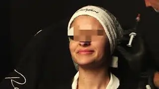 Dr M. Kuldeep &ndash; Harmonisation esth&eacute;tique du tiers moyen et inf&eacute;rieur du visage